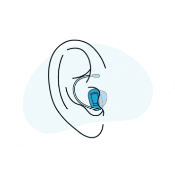 Remote Hearing Aid